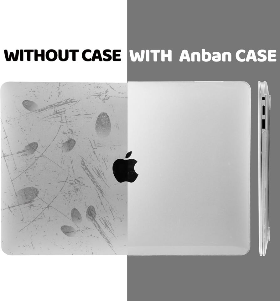 Apple MacBook Pro 14 M4 Pro 2024 Çipli Darbelere Dayanıklı Ön Arka Clear Parlak Kapak Kılıf ve Koruyucu Set A3401 Şeffaf